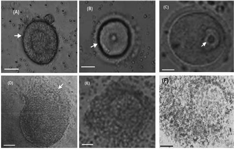 In Vitro Growth And Differentiation Of Preantral Follicles From