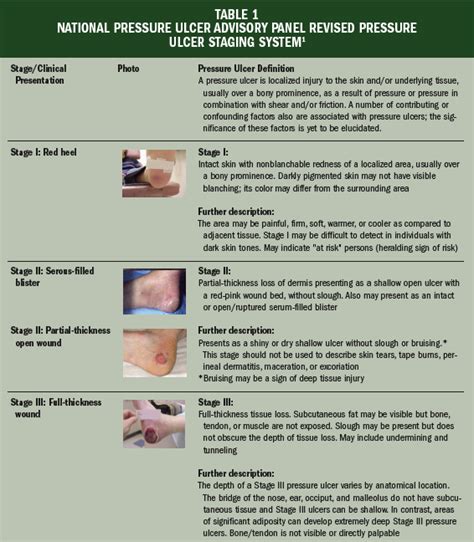 Pressure Ulcer Stages Pressure Ulcer Staging Pressure