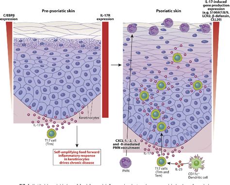 Figure 1 From Psoriasis Pathogenesis And The Development Of Novel