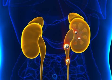 What Is Ureteroscopy And How Does It Help Treat Kidney Stones