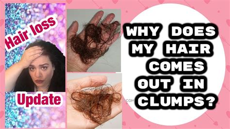 Happened 4 months ago (may 2018) one morning as i was combing my hair preparing for work, i noticed some hair falling out and getting stuck to my comb. Why Is My Hair Falling out in CLUMPS? RAPID HAIR GROWTH ...