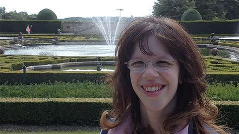 Williams Syndrome How It Affects My Life On A Daily Basis Mencap