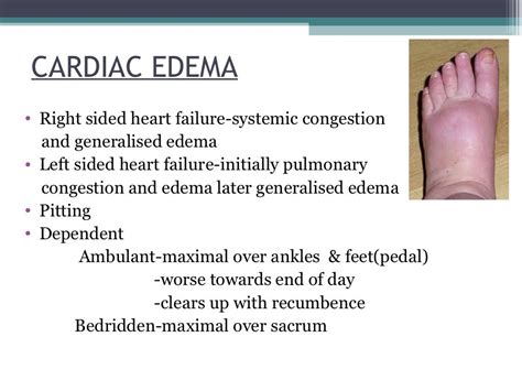Clinical Features Of Edema