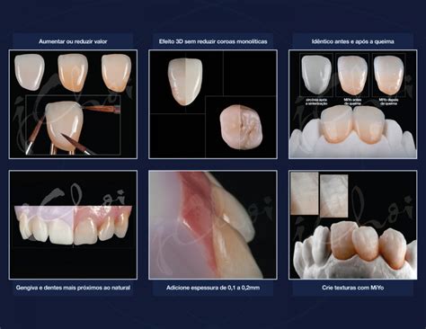 Odontomega Dental And Dental Prosthesis Products