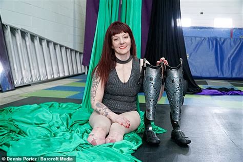 Double Amputee Reveals Moment She Found Out Her Feet Were Coming Off Celebritywshow