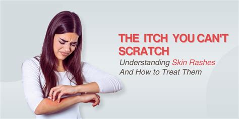 The Itch You Cant Scratch Understanding Skin Rashes
