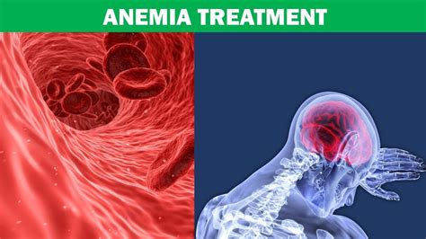 The Role Of Iron Vitamin B12 And Red Blood Cells In Anemia