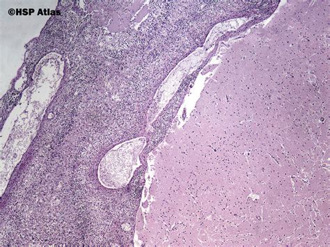 Hsp Atlas Histopathology Atlas