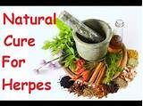 Holistic Cure For Genital Herpes Pictures