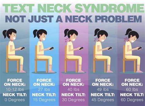Text Neck Syndrome Belton Temple Texas Centex Chiropractic