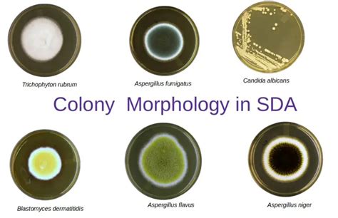 Sabouraud Agar Sda Composition Uses Colony Morphology