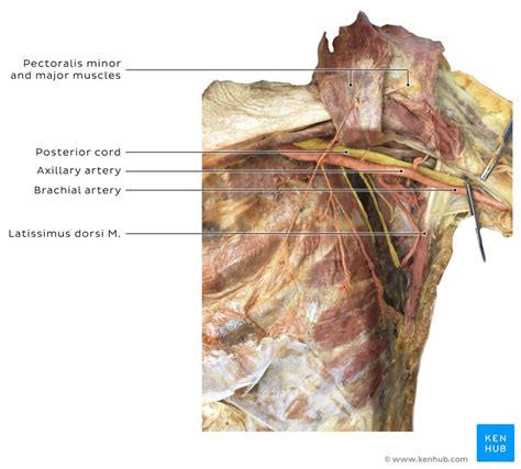 Brachial Artery Injury Clinical Case Anatomy Causes Kenhub