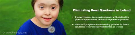 Health Tip On Eliminating Down Syndrome In Iceland Health Tips