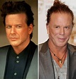 The Evolution Of Mickey Rourke Before And After Plastic Surgery ...