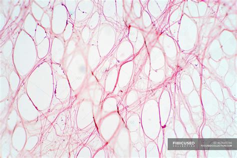 Areolar Connective Tissue Light Micrograph Fibroblasts Normal
