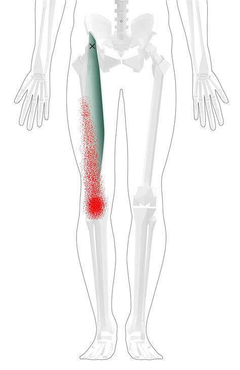Thigh Trigger Points Groin Trigger Points Tips Exercises