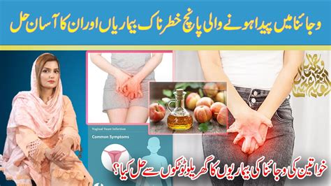 Five Common Vaginal Diseases Symptoms Causes And Treatments Dr