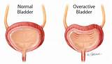 Photos of Overactive Bladder Doctor