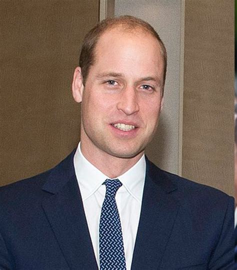 Prince Harry Balding What We Know So Far The Bald Gent