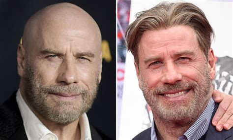 John Travolta Hair Transplant Hair Transplant World ️