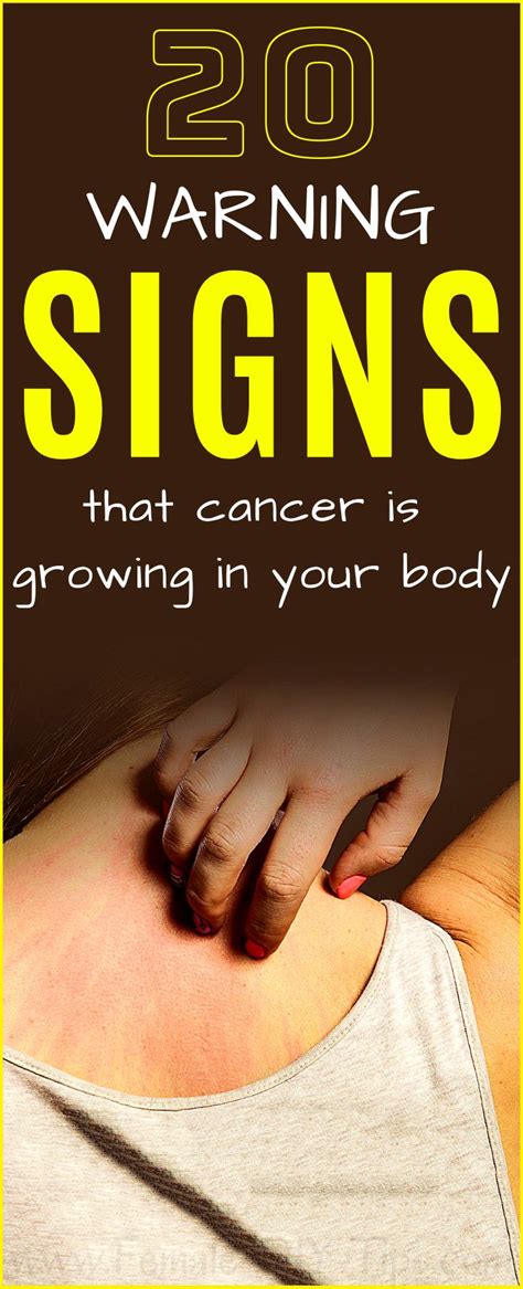 20 Warning Signs That Cancer Is Growing In Your Body In 2020 Health