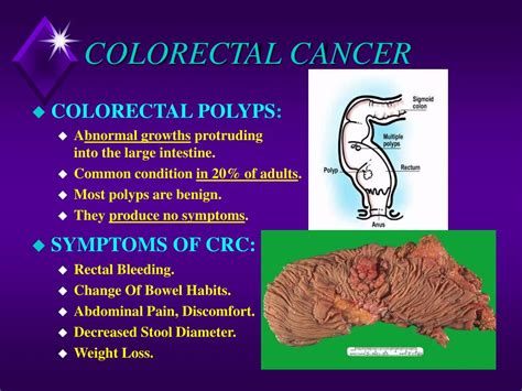 Ppt Colorectal Cancer Powerpoint Presentation Free Download Id563571