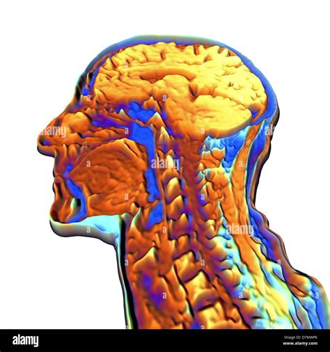 Coloured Mri Scan Human Head Hi Res Stock Photography And Images Alamy