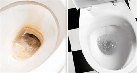 How To Clean Poop Stains From Toilet Bowl 9 Steps Helpful