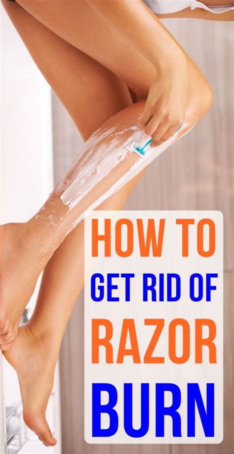 How To Get Rid Of Razor Burn