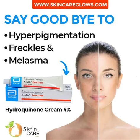 Hydroquinone Cream 4 Melalite Forte【 Buy Now】 Skin Whitening Gel