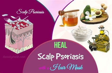 16 Best Natural Home Remedies For Scalp Psoriasis