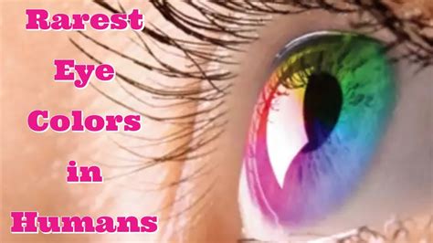 rarest eye colors in the world all possible eye colors in humans heterochromia aniridia