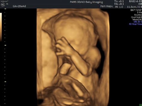 Gender Reveal Scan Private One On One Pregnancy And Fertility