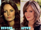 Jaclyn Smith Plastic Surgery Before and After Photos - Lovely Surgery ...