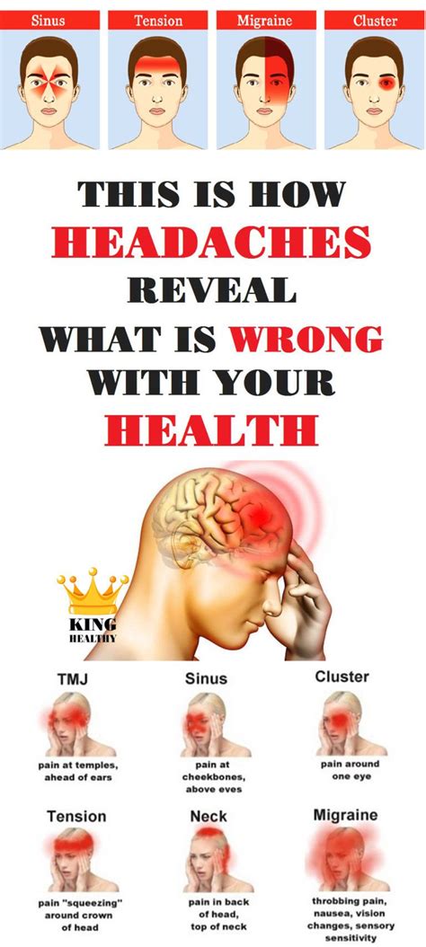 This Is How Headaches Reveal What Is Wrong With Your Health King