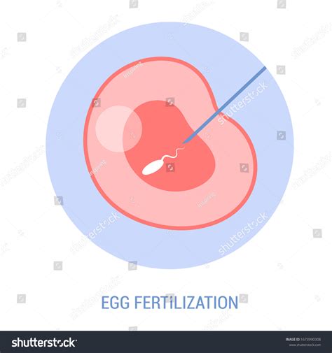 Vitro Fertilization Concept Artificial Fertilization Woman Stock Vector