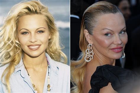 Celebs Who Are Unrecognizable After Having Plastic Surgery Page 35 Of 42 Misterstocks