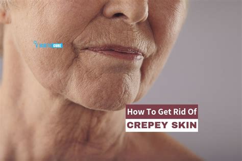 How To Get Rid Of Crepey Skin Naturally At Home