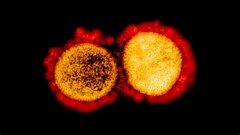 The Coronavirus Could Dodge Some Treatments Study Suggests The New