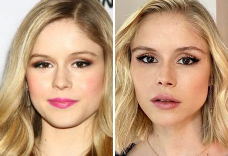 Erin Moriarty Plastic Surgery Is That Why She Looks Different