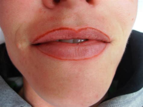 Permanent Cosmetics Before After And Healed Lip Liner