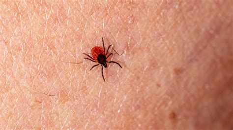 Preventing Lyme Disease Symptoms Risks And Tick Bite Prevention