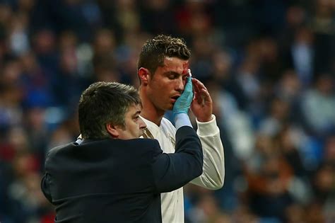 Cristiano Ronaldo Bloody Face Real Madrid Striker Needs Stitches Near Eye