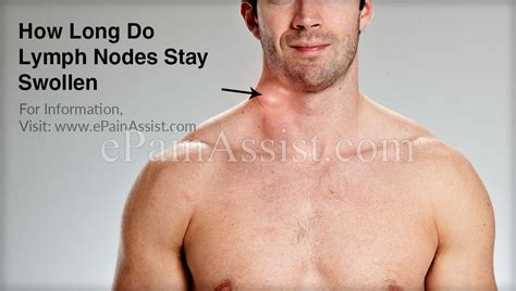 How Long Do Lymph Nodes Stay Swollen