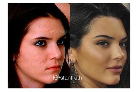 Kendall Jenner Has Changed Shes Not New To Facetune But She