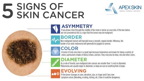 Skin Cancer Apex Dermatology And Skin Surgery Center Cleveland Oh