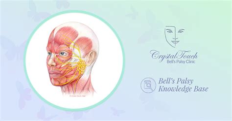About Bells Palsy And Its Recovery • Crystal Touch Bells Palsy Clinic