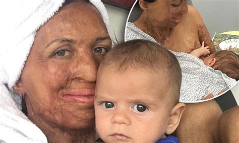 Burns Survivor And New Mother Turia Pitt Reveals Latest Mindset Hack Daily Mail Online