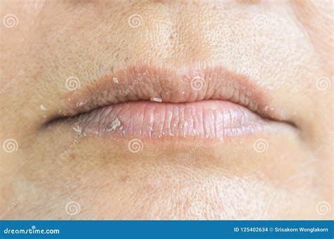 Dry Lips And Peeling Stock Photo Image Of Macro Blue 125402634