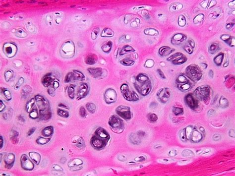 Hyaline Cartilage Medical Pictures Info Health Definitions Photos
